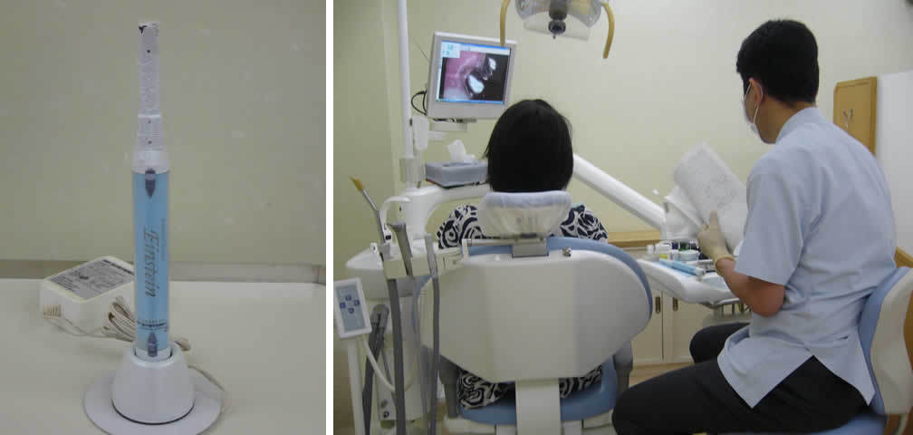 足立区綾瀬の歯医者　新井歯科医院　口腔内カメラを使用した治療説明