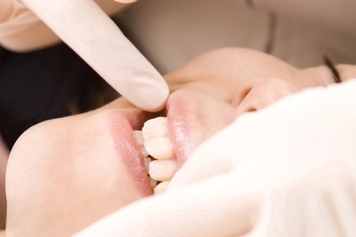 足立区綾瀬の歯医者　新井歯科医院　虫歯治療　詰め物や被せ物を装着