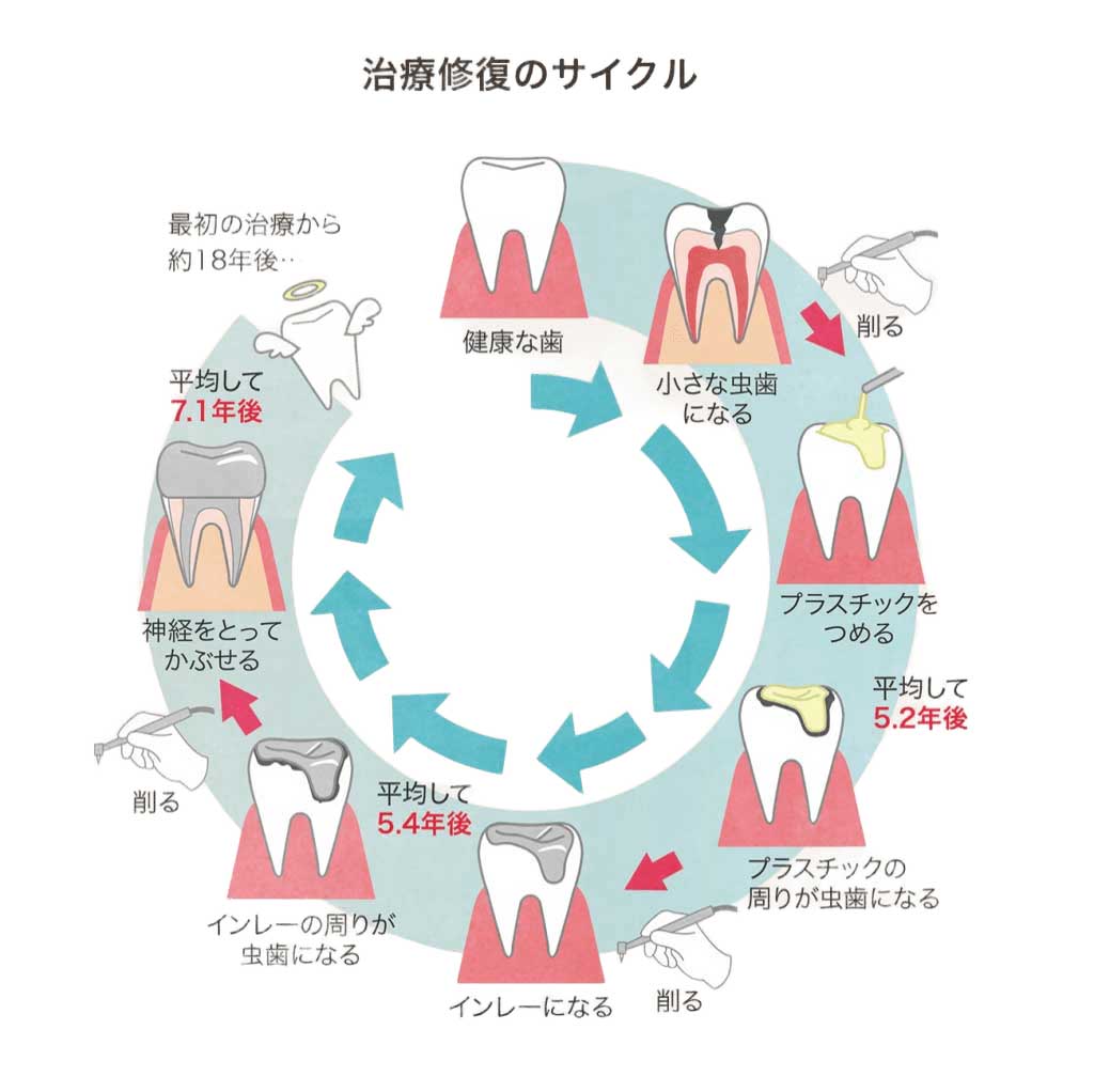 綾瀬の歯医者、新井歯科医院が、神経を抜かない治療にこだわる理由