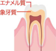 足立区綾瀬の歯医者　新井歯科医院　歯が痛い時の応急処置